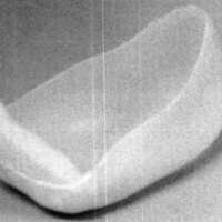 http://www.oandplibrary.org/cpo/images/1988_01_024/1988_01_024-4.jpg