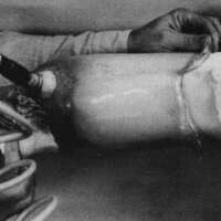 http://www.oandplibrary.org/cpo/images/1987_02_101/1987_02_101-7.jpg