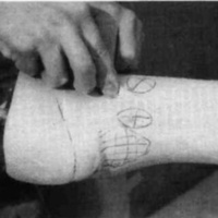 http://www.oandplibrary.org/cpo/images/1987_03_118/1987_03_118-08.jpg