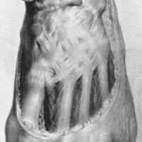 http://www.oandplibrary.org/al/images/1961_01_004/a005.jpg