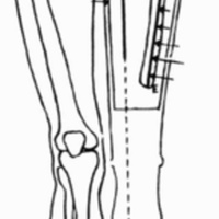 http://www.oandplibrary.org/cpo/images/1988_02_081/1988_02_081-01.jpg