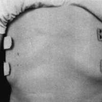http://www.oandplibrary.org/cpo/images/1983_02_009/1983_02_009-6.jpg