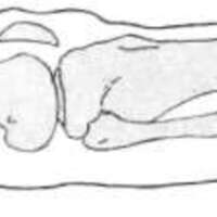 http://www.oandplibrary.org/al/images/1969_01_001/spring69-10.jpg
