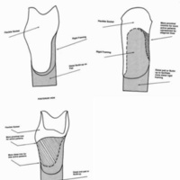 http://www.oandplibrary.org/cpo/images/1986_02_093/1986_02_093-6.jpg