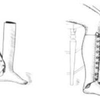 http://www.oandplibrary.org/al/images/1961_01_052/c003.jpg