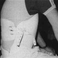 http://www.oandplibrary.org/cpo/images/1987_02_095/1987_02_095-04.jpg