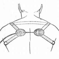 http://www.oandplibrary.org/cpo/images/1978_02_002/1978_02_002-2.jpg