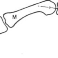 http://www.oandplibrary.org/al/images/1955_02_022/1955-MayOCRBatch-15.jpg