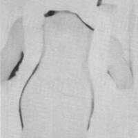 http://www.oandplibrary.org/cpo/images/1985_04_035/1985_04_035-03.jpg