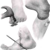 http://www.oandplibrary.org/al/images/1955_01_004/1955-JanuaryOCRBatchc-12.jpg