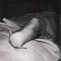 http://www.oandplibrary.org/al/images/1969_01_001/spring69-01.jpg