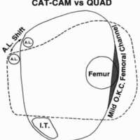 http://www.oandplibrary.org/cpo/images/1985_04_015/1985_04_015-04.jpg