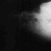 http://www.oandplibrary.org/cpo/images/1988_02_061/1988_02_061-4.jpg