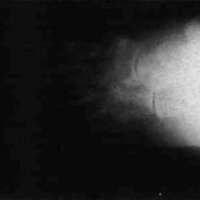 http://www.oandplibrary.org/cpo/images/1988_02_061/1988_02_061-5.jpg
