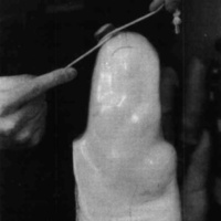 http://www.oandplibrary.org/cpo/images/1987_03_118/1987_03_118-10.jpg