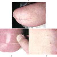 http://www.oandplibrary.org/al/images/1956_01_020/sp56-b008.jpg