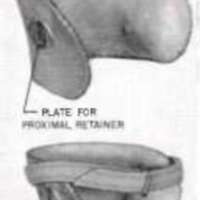 http://www.oandplibrary.org/al/images/1955_03_026/tmp48A-10.jpg