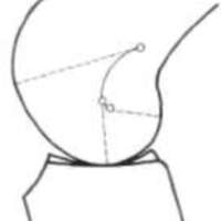 http://www.oandplibrary.org/al/images/1962_02_004/tmp623-08.jpg