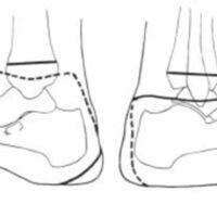 http://www.oandplibrary.org/al/images/1961_01_004/a007.jpg