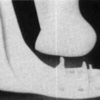 http://www.oandplibrary.org/cpo/images/1988_01_029/1988_01_029-1.jpg
