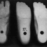 http://www.oandplibrary.org/cpo/images/1987_03_154/1987_03_154-06.jpg