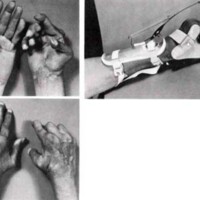 http://www.oandplibrary.org/al/images/1969_01_013/spring69_17.jpg