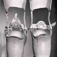 http://www.oandplibrary.org/al/images/1962_02_074/tmp62F-1.jpg