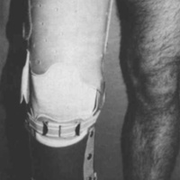 http://www.oandplibrary.org/cpo/images/1984_02_004/1984_02_004-06.jpg