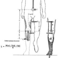 http://www.oandplibrary.org/al/images/1962_02_016/tmp624-5.jpg