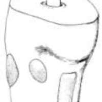 http://www.oandplibrary.org/al/images/1962_02_025/tmp62D-08.jpg