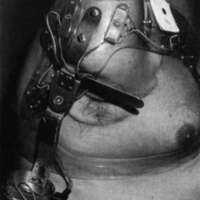 http://www.oandplibrary.org/cpo/images/1987_01_045/1987_01-045-06.jpg