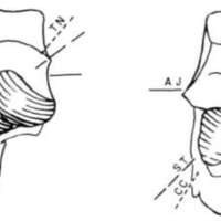 http://www.oandplibrary.org/al/images/1969_01_049/spring69-49.jpg