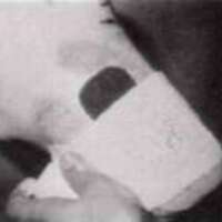 http://www.oandplibrary.org/al/images/1971_01_001/1971_01_001-23.jpg