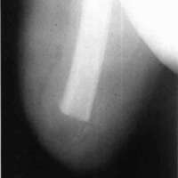 http://www.oandplibrary.org/cpo/images/1984_01_009/1984_01_009-1.jpg