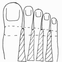 http://www.oandplibrary.org/cpo/images/1986_01_015/1986_01_015-11.jpg