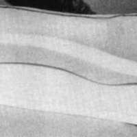 http://www.oandplibrary.org/cpo/images/1988_02_067/1988_02_067-03.jpg