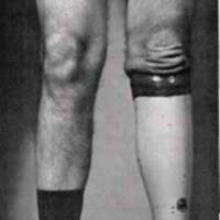 http://www.oandplibrary.org/al/images/1962_02_074/tmp62F-3.jpg