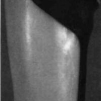 http://www.oandplibrary.org/cpo/images/1985_04_027/1985_04_027-3.jpg