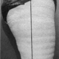 http://www.oandplibrary.org/cpo/images/1985_04_009/1985_04_009-04.jpg
