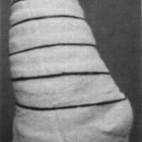 http://www.oandplibrary.org/cpo/images/1985_04_009/1985_04_009-07.jpg
