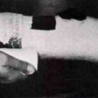 http://www.oandplibrary.org/al/images/1969_01_001/spring69-03.jpg