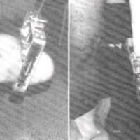 http://www.oandplibrary.org/al/images/1966_02_005/aut66-2-12.jpg