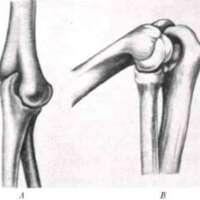 http://www.oandplibrary.org/al/images/1955_03_004/tmp482-11.jpg