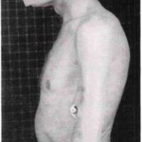 http://www.oandplibrary.org/al/images/1957_01_004/1957-Spring-15.jpg