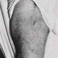 http://www.oandplibrary.org/al/images/1968_02_028/1968_02_028-01.jpg