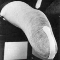 http://www.oandplibrary.org/al/images/1970_01_057/tmp39A-02.jpg