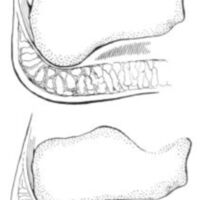 http://www.oandplibrary.org/al/images/1961_01_004/a017.jpg