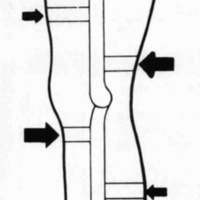http://www.oandplibrary.org/cpo/images/1984_02_004/1984_02_004-04.jpg