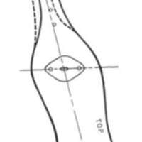 http://www.oandplibrary.org/al/images/1955_03_026/tmp48A-11.jpg