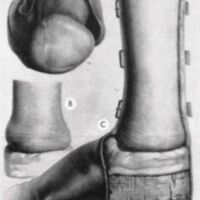 http://www.oandplibrary.org/al/images/1961_01_004/a006.jpg